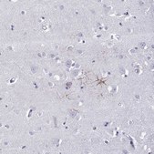 Anti-KCNF1 Prestige Antibodies® Powered by Atlas Antibodies, affinity isolated antibody