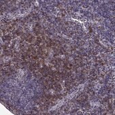 Anti-CD28 antibody produced in rabbit Prestige Antibodies® Powered by Atlas Antibodies, affinity isolated antibody