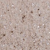 Anti-MCAT antibody produced in rabbit Prestige Antibodies® Powered by Atlas Antibodies, affinity isolated antibody, buffered aqueous glycerol solution