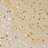 Anti-S100A4 antibody produced in rabbit