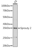 Anti-Sprouty 2 Antibody, clone 10M8H1, Rabbit Monoclonal