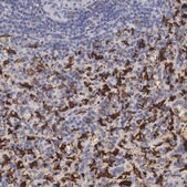 抗HMOX1 兔抗 Prestige Antibodies® Powered by Atlas Antibodies, affinity isolated antibody, buffered aqueous glycerol solution