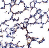 Anti-TRPC6 (ab1) antibody produced in rabbit affinity isolated antibody, buffered aqueous solution