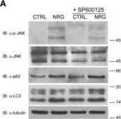 Anti-LC3B antibody produced in rabbit ~1 mg/mL, affinity isolated antibody, buffered aqueous solution