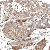 Monoclonal Anti-MYO10 antibody produced in mouse Prestige Antibodies® Powered by Atlas Antibodies, clone CL9032, purified immunoglobulin, buffered aqueous glycerol solution