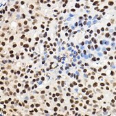 Anti- HIF1α antibody produced in rabbit