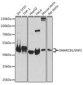 Anti- SMARCB1/SNF5 antibody produced in rabbit