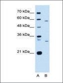 Anti-CD36 antibody produced in rabbit affinity isolated antibody