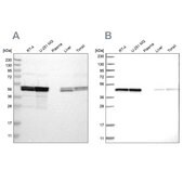 Anti-TUFM antibody produced in rabbit Prestige Antibodies® Powered by Atlas Antibodies, affinity isolated antibody, buffered aqueous glycerol solution