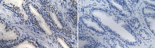 Anti-BRG1/SMARCA4 Antibody, clone 20C3.2 ZooMAb® Mouse Monoclonal recombinant, expressed in HEK 293 cells