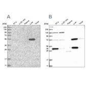 Anti-UGP2 antibody produced in rabbit Prestige Antibodies® Powered by Atlas Antibodies, affinity isolated antibody, buffered aqueous glycerol solution