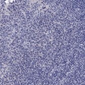 Anti-CETN1 antibody produced in rabbit Prestige Antibodies® Powered by Atlas Antibodies, affinity isolated antibody, buffered aqueous glycerol solution