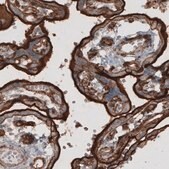 Monoclonal Anti-EZR antibody produced in mouse Prestige Antibodies® Powered by Atlas Antibodies, clone CL2378, purified immunoglobulin, buffered aqueous glycerol solution