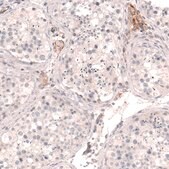 Monoclonal Anti-THSD7A antibody produced in mouse Prestige Antibodies® Powered by Atlas Antibodies, clone CL3779, purified immunoglobulin, buffered aqueous glycerol solution