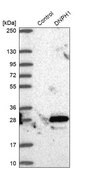 Anti-DNPH1 antibody produced in rabbit Prestige Antibodies® Powered by Atlas Antibodies, affinity isolated antibody, buffered aqueous glycerol solution, ab2
