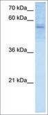 Anti-RBPJ antibody produced in rabbit affinity isolated antibody
