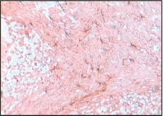 抗胶质纤维酸性蛋白 兔抗 IgG fraction of antiserum, buffered aqueous solution