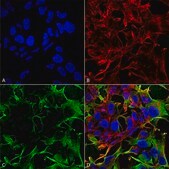 Monoclonal Anti-beta 4 Spectrin-FITC antibody produced in mouse clone S393-2