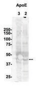 Anti-APOE (N-terminal) antibody produced in rabbit affinity isolated antibody