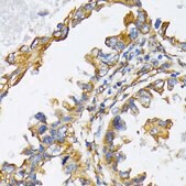 Anti-HSP90B1 antibody produced in rabbit