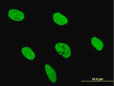 ANTI-RUNX2 antibody produced in mouse clone 3F5, purified immunoglobulin, buffered aqueous solution