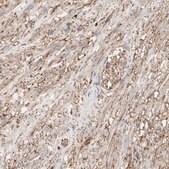 Anti-ANXA6 antibody produced in rabbit Prestige Antibodies® Powered by Atlas Antibodies, affinity isolated antibody, buffered aqueous glycerol solution