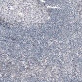 Monoclonal Anti--G6PC antibody produced in mouse Prestige Antibodies® Powered by Atlas Antibodies, clone CL5817, purified immunoglobulin, buffered aqueous glycerol solution