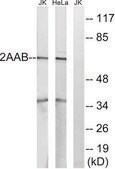 Anti-PPP2R1B antibody produced in rabbit affinity isolated antibody