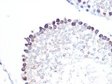 Anti-Stathmin 1 antibody produced in rabbit