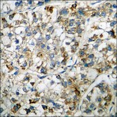 Anti-phospho-PKR (pThr446) antibody produced in rabbit affinity isolated antibody