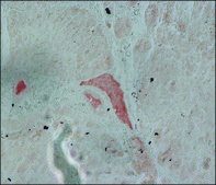 Anti-Fibroblast Growth Factor Receptor-2, Extracellular antibody produced in rabbit affinity isolated antibody, buffered aqueous solution
