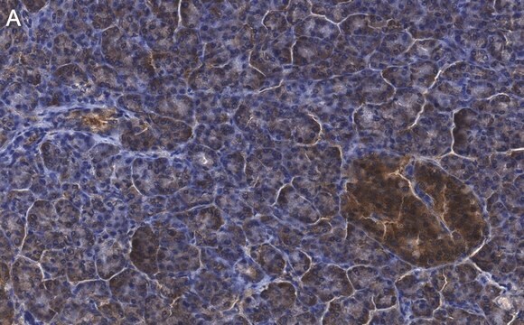 Anti-CFTR Antibody, clone 1C22 ZooMAb&#174; Rabbit Monoclonal recombinant, expressed in HEK 293 cells