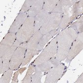 Anti-PSMC1 antibody produced in rabbit Prestige Antibodies® Powered by Atlas Antibodies, affinity isolated antibody, buffered aqueous glycerol solution