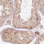 Monoclonal Anti-RHOT1 antibody produced in mouse Prestige Antibodies® Powered by Atlas Antibodies, clone CL1083, purified immunoglobulin, buffered aqueous glycerol solution
