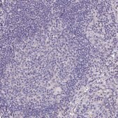 Anti-APOB antibody produced in rabbit Prestige Antibodies® Powered by Atlas Antibodies, affinity isolated antibody, buffered aqueous glycerol solution