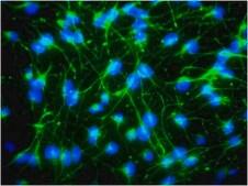 Anti-Nestin Antibody, clone rat-401, Alexa Fluor™ 488 conjugate clone rat-401, from mouse, ALEXA FLUOR™ 488