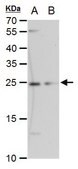 Monoclonal Anti-ETHE1 antibody produced in mouse clone GT1621, affinity isolated antibody