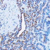 Anti-DDIT3/CHOP antibody produced in rabbit