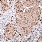 Monoclonal Anti-Msh3 Antibody Produced In Mouse Prestige Antibodies® Powered by Atlas Antibodies, clone CL14064, affinity isolated antibody, buffered aqueous glycerol solution