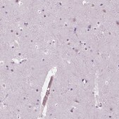 抗-MKI67 兔抗 Ab2, Prestige Antibodies® Powered by Atlas Antibodies, affinity isolated antibody, buffered aqueous glycerol solution