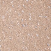 Anti-L1CAM antibody produced in rabbit Prestige Antibodies® Powered by Atlas Antibodies, affinity isolated antibody, buffered aqueous glycerol solution