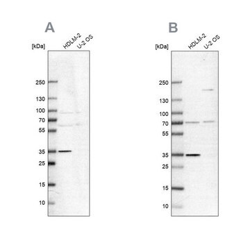 Anti-TTC19 antibody produced in rabbit Prestige Antibodies® Powered by Atlas Antibodies, affinity isolated antibody, buffered aqueous glycerol solution