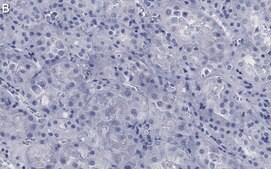 Anti-Ezrin Antibody, clone 1D15 ZooMAb® Rabbit Monoclonal recombinant, expressed in HEK 293 cells