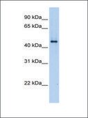 Anti-SerPINE1 (AB1) antibody produced in rabbit affinity isolated antibody