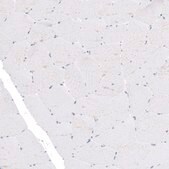 Monoclonal Anti-TYRP1 antibody produced in mouse Prestige Antibodies® Powered by Atlas Antibodies, clone CL4917, purified immunoglobulin, buffered aqueous glycerol solution