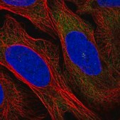 Anti-RRM1 antibody produced in rabbit Prestige Antibodies® Powered by Atlas Antibodies, affinity isolated antibody, buffered aqueous glycerol solution