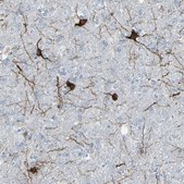 Anti-MAP2 antibody produced in rabbit affinity isolated antibody, buffered aqueous glycerol solution