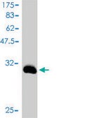 Monoclonal Anti-TNP1 antibody produced in mouse clone 1B5, purified immunoglobulin, buffered aqueous solution