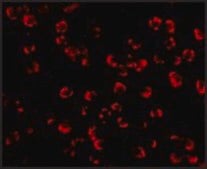 Anti-PAK5 antibody produced in rabbit affinity isolated antibody, buffered aqueous solution