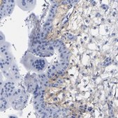 Anti-HAPLN1 antibody produced in rabbit Prestige Antibodies® Powered by Atlas Antibodies, affinity isolated antibody, buffered aqueous glycerol solution, Ab1